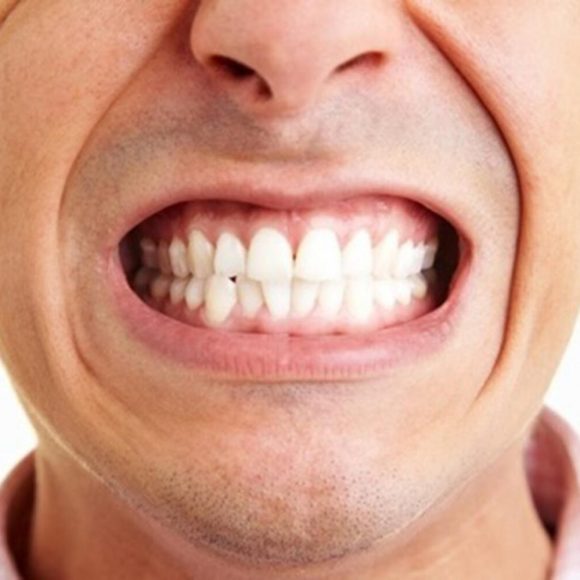 Botoks ile Diş Gıcırdatma Tedavisi