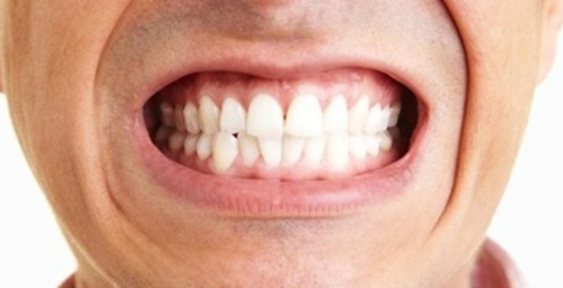 Botoks ile Diş Gıcırdatma Tedavisi